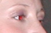 enlarge photo showing obvious red eye