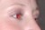 smaller photo showing obvious red eye